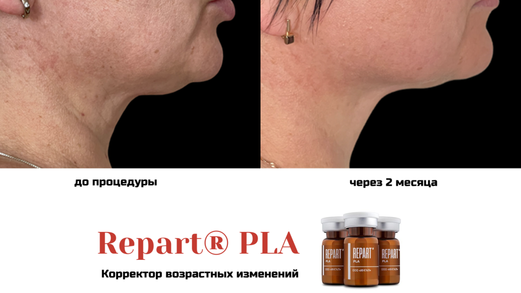 До после.png